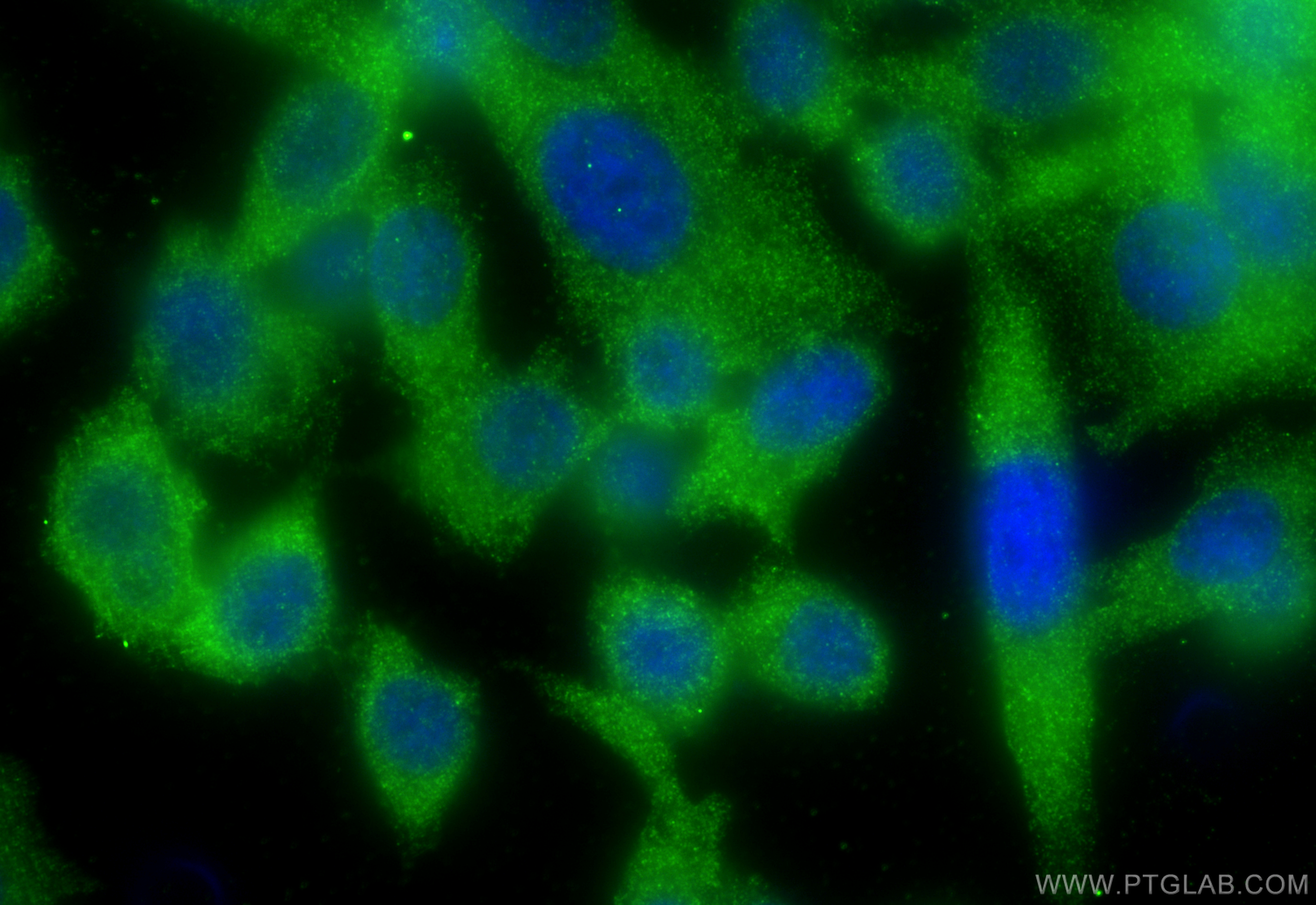 Immunofluorescence (IF) / fluorescent staining of PC-3 cells using ATG12 Polyclonal antibody (11264-1-AP)