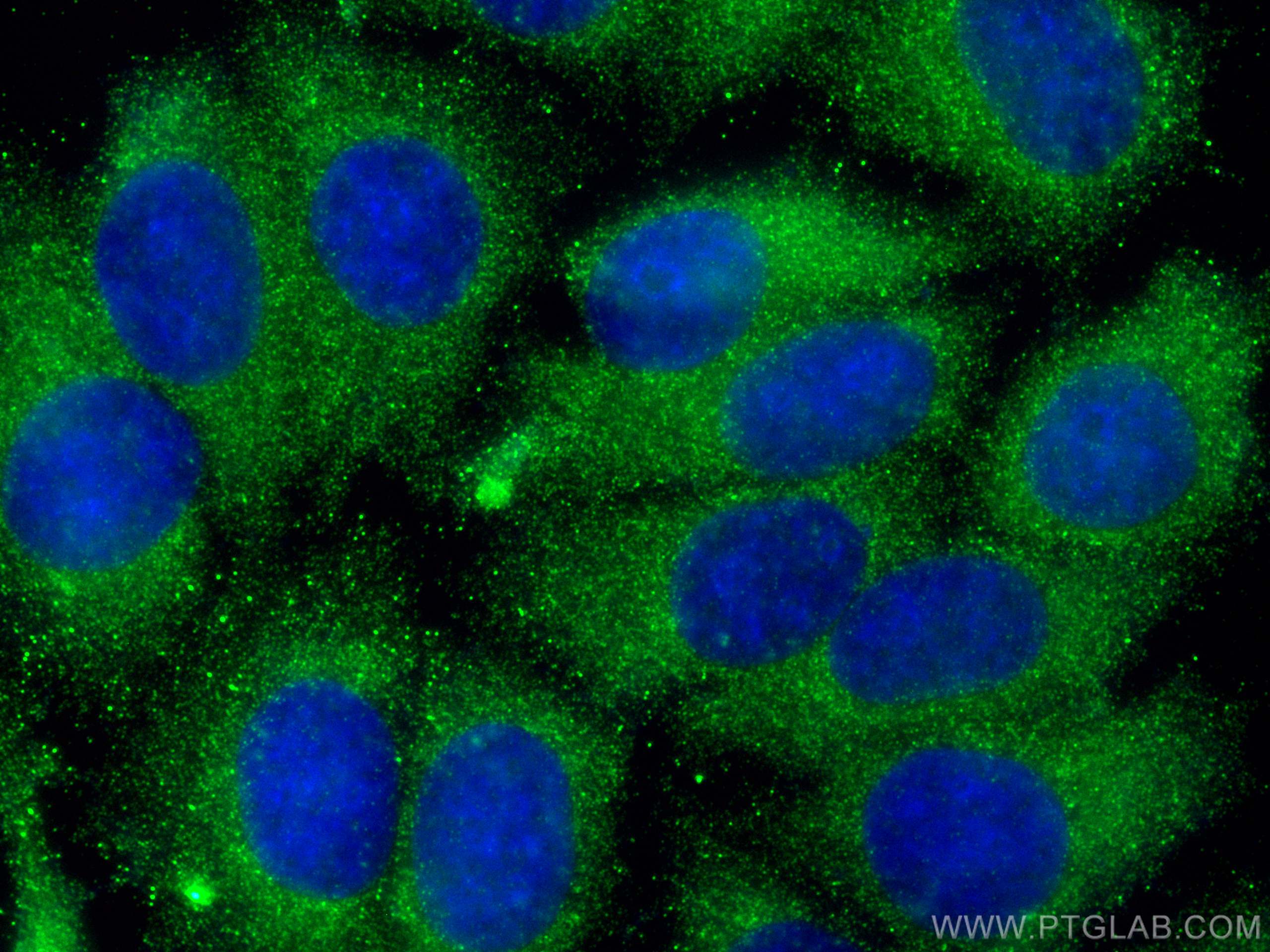 Immunofluorescence (IF) / fluorescent staining of MCF-7 cells using ATG2A Polyclonal antibody (23226-1-AP)