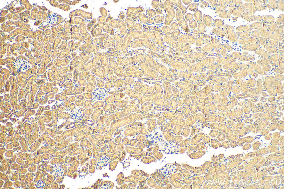 Immunohistochemistry (IHC) staining of mouse kidney tissue using ATG2A Polyclonal antibody (23226-1-AP)