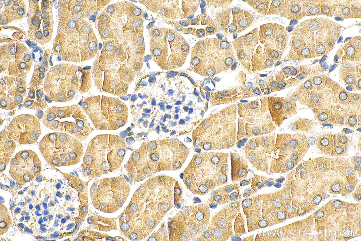 Immunohistochemistry (IHC) staining of mouse kidney tissue using ATG2A Polyclonal antibody (23226-1-AP)