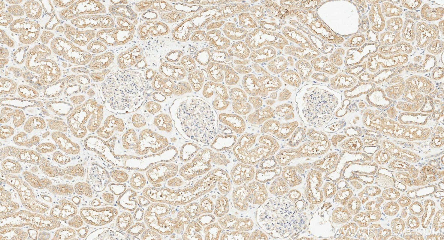 Immunohistochemistry (IHC) staining of human kidney tissue using ATG2A Polyclonal antibody (23226-1-AP)