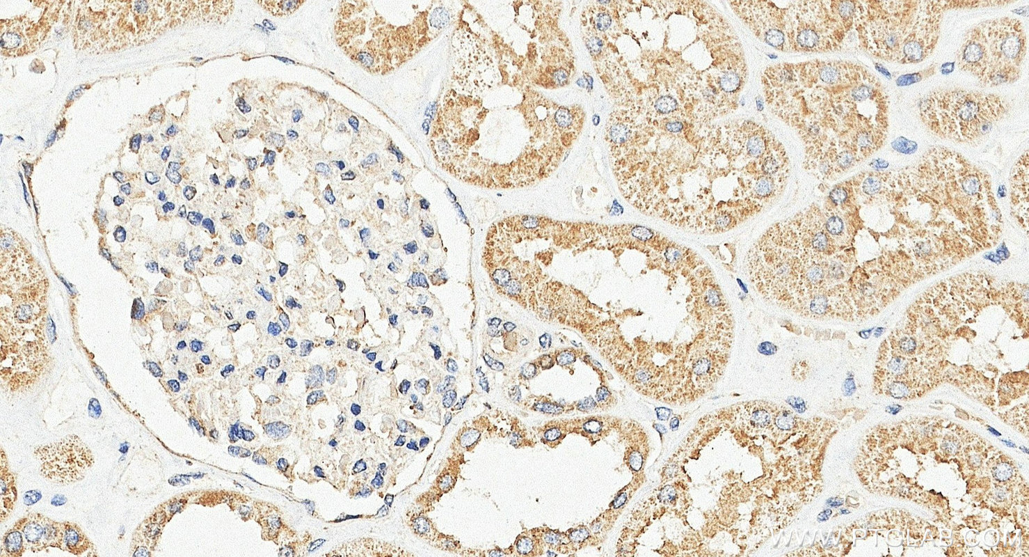 Immunohistochemistry (IHC) staining of human kidney tissue using ATG2A Polyclonal antibody (23226-1-AP)