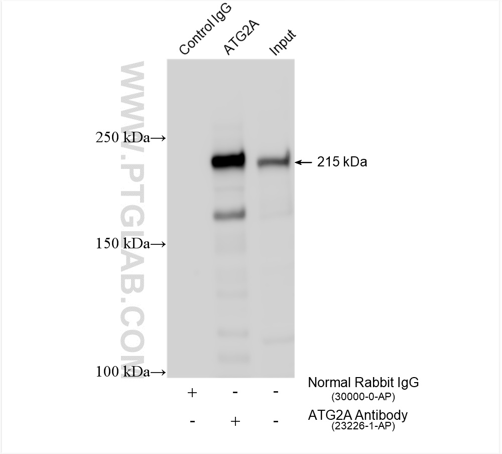 Immunoprecipitation (IP) experiment of K-562 cells using ATG2A Polyclonal antibody (23226-1-AP)