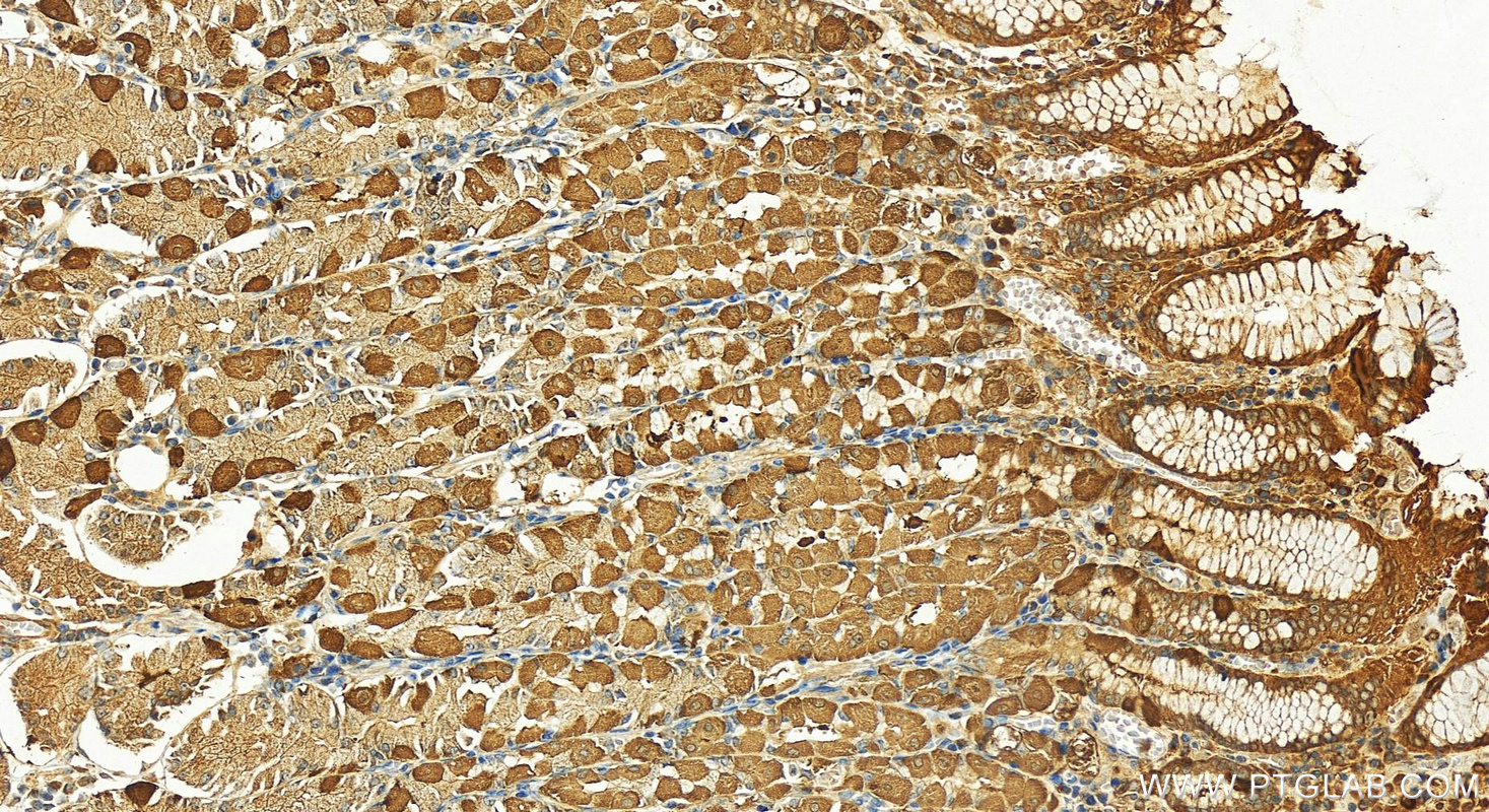 Immunohistochemistry (IHC) staining of human stomach tissue using ATG2B Polyclonal antibody (25155-1-AP)