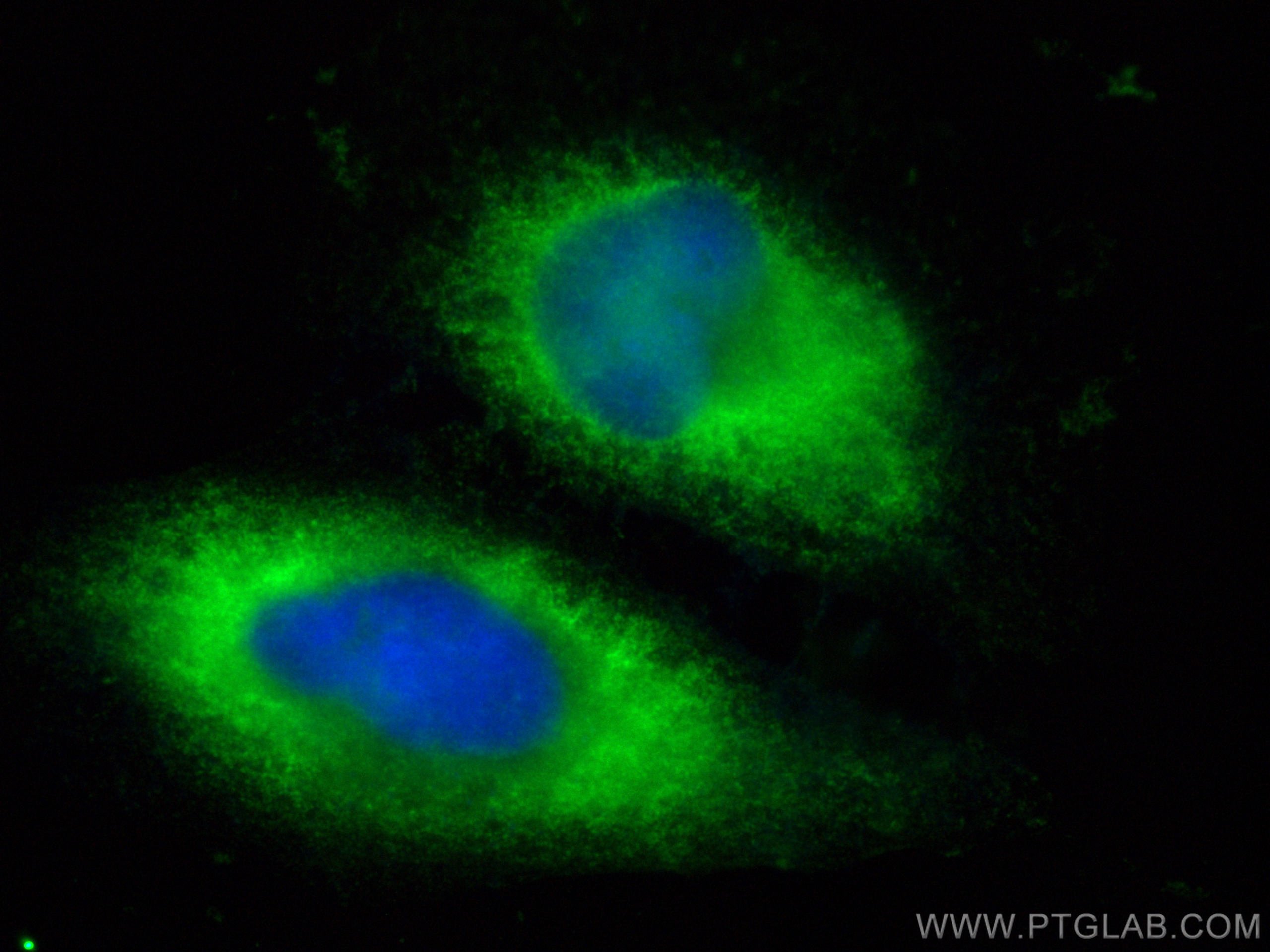 Immunofluorescence (IF) / fluorescent staining of HeLa cells using CoraLite® Plus 488-conjugated ATG4B Monoclonal ant (CL488-67727)