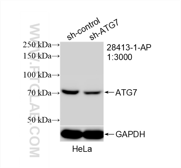 Western Blot (WB) analysis of HeLa cells using ATG7 Polyclonal antibody (28413-1-AP)