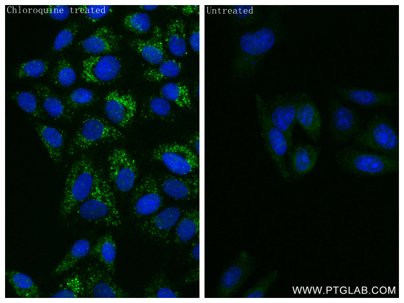 Immunofluorescence (IF) / fluorescent staining of HepG2 cells using ATG8L Recombinant antibody (83817-1-RR)