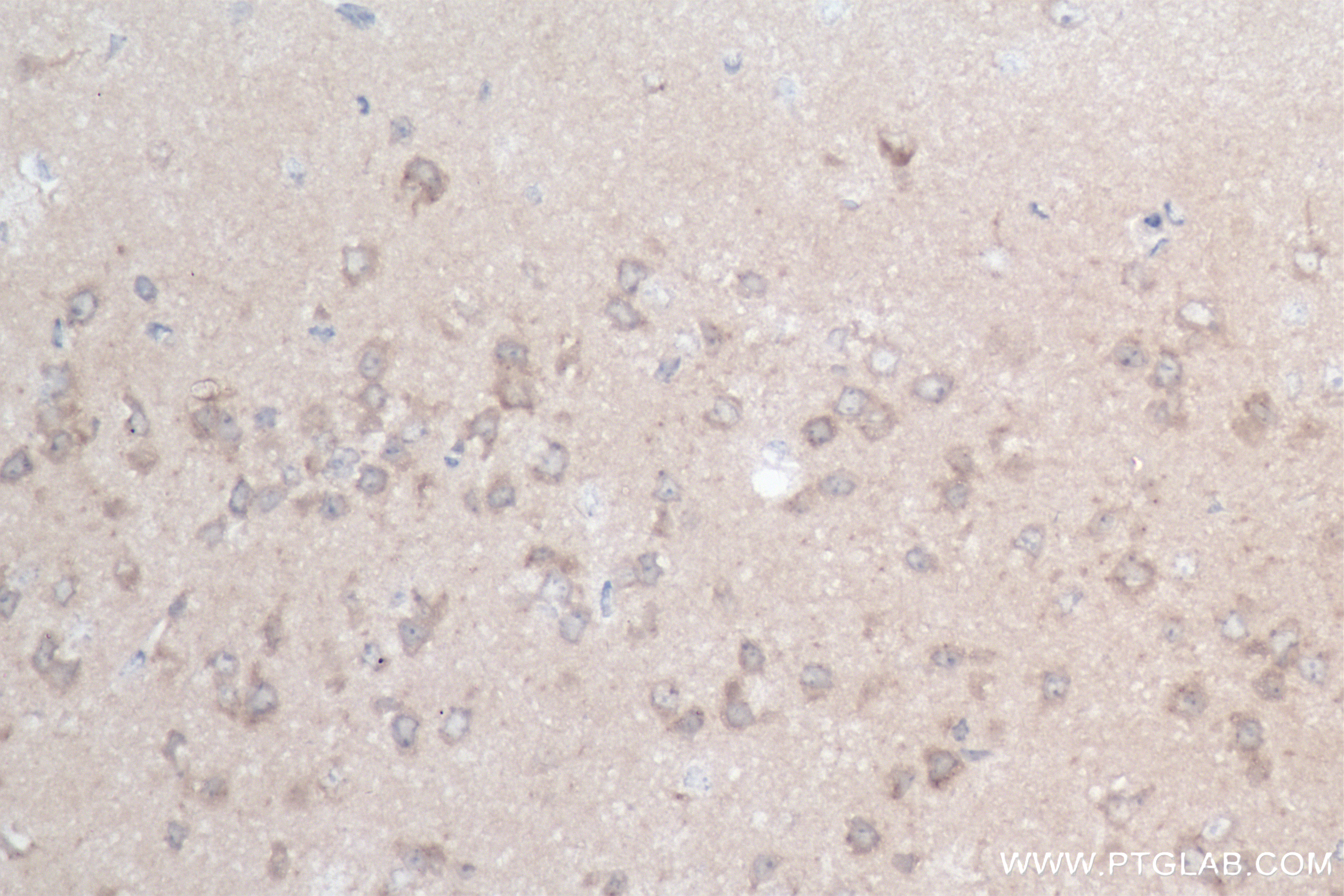 Immunohistochemistry (IHC) staining of mouse brain tissue using GABARAPL1 Recombinant antibody (83817-1-RR)