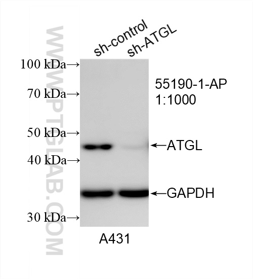 Western Blot (WB) analysis of A431 cells using ATGL Polyclonal antibody (55190-1-AP)