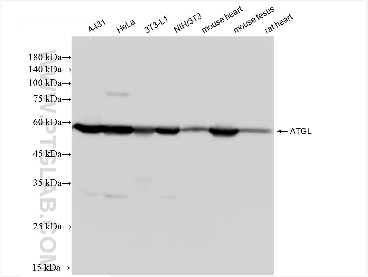 Western Blot (WB) analysis of various lysates using ATGL Recombinant antibody (84736-1-RR)