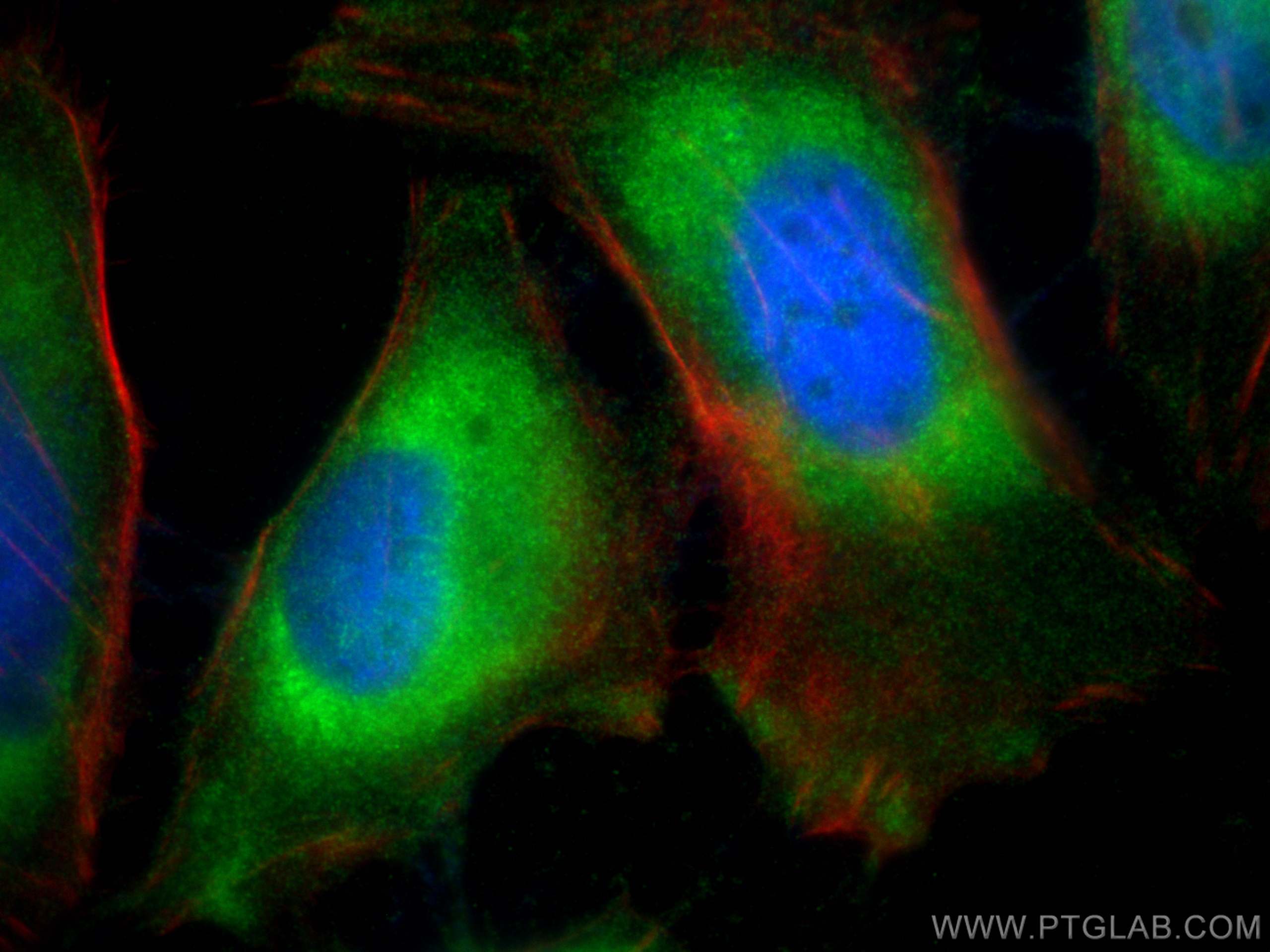 Immunofluorescence (IF) / fluorescent staining of HeLa cells using ATIC Polyclonal antibody (10726-1-AP)