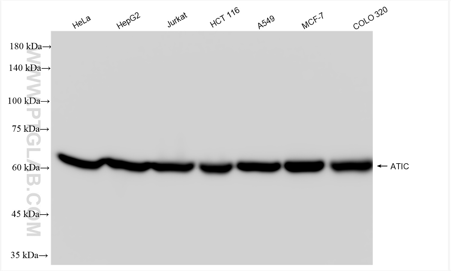 Western Blot (WB) analysis of various lysates using ATIC Recombinant antibody (84798-5-RR)