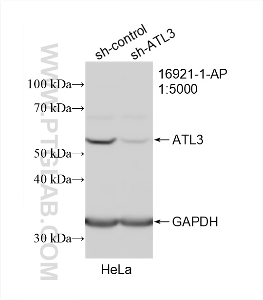 Western Blot (WB) analysis of HeLa cells using ATL3 Polyclonal antibody (16921-1-AP)