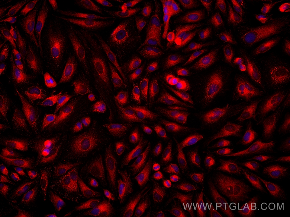 Immunofluorescence (IF) / fluorescent staining of HeLa cells using ATL3 Monoclonal antibody (68516-1-Ig)