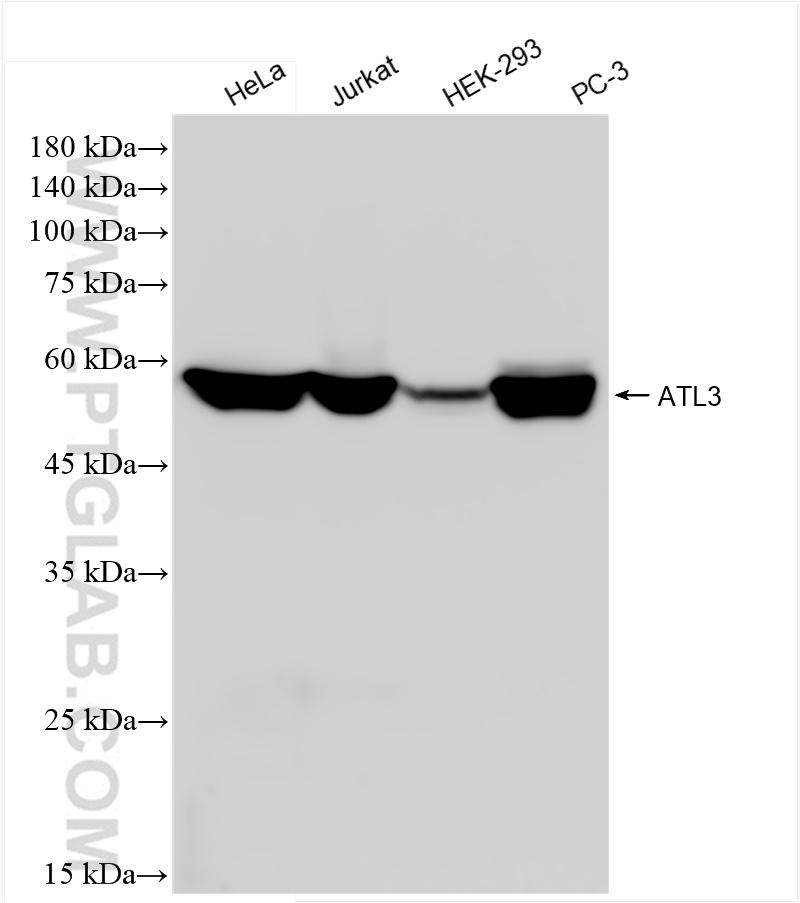 Western Blot (WB) analysis of various lysates using ATL3 Recombinant antibody (84578-3-RR)