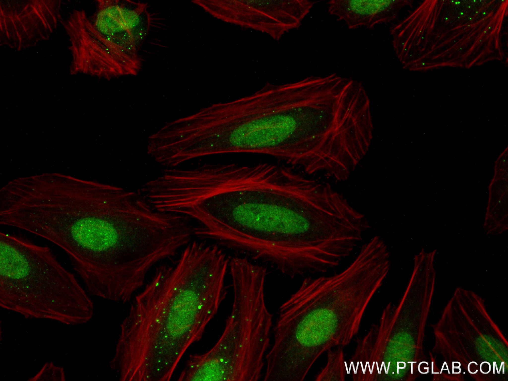 Immunofluorescence (IF) / fluorescent staining of HeLa cells using ATM Recombinant antibody (83608-4-RR)