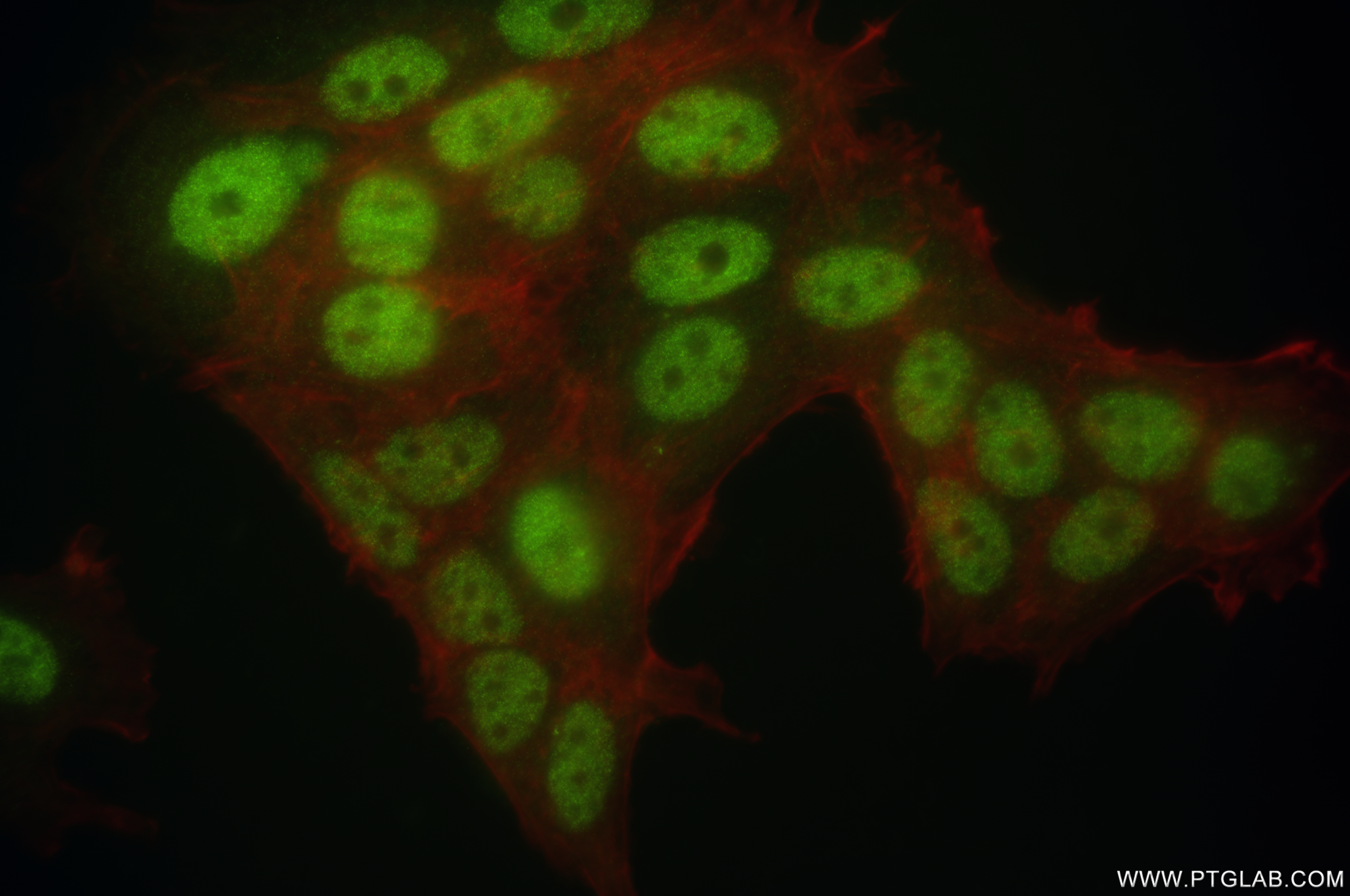 Immunofluorescence (IF) / fluorescent staining of MCF-7 cells using ATM Recombinant antibody (83608-5-RR)