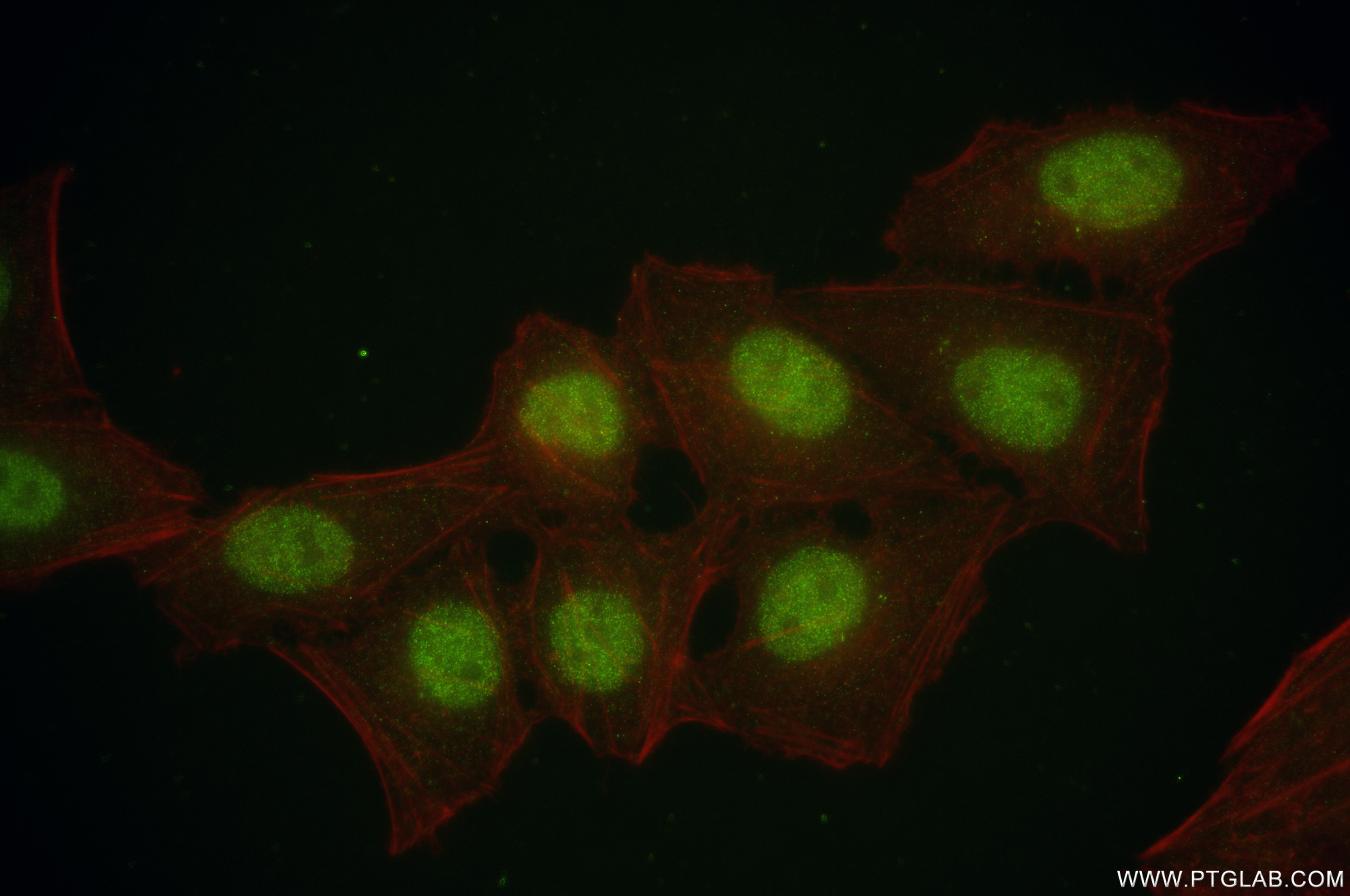 Immunofluorescence (IF) / fluorescent staining of HepG2 cells using ATM Recombinant antibody (83608-5-RR)