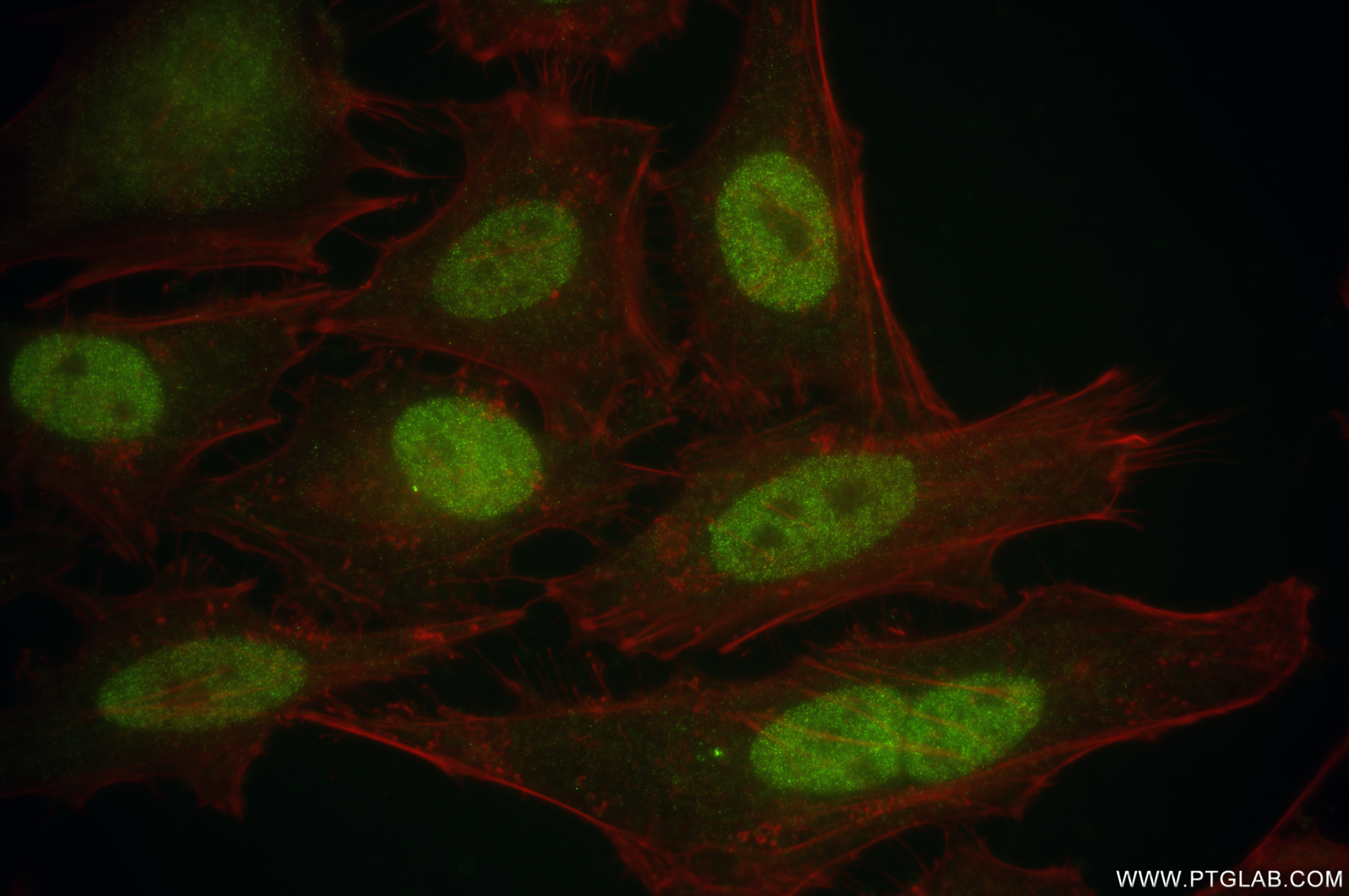 Immunofluorescence (IF) / fluorescent staining of HeLa cells using ATM Recombinant antibody (83608-5-RR)