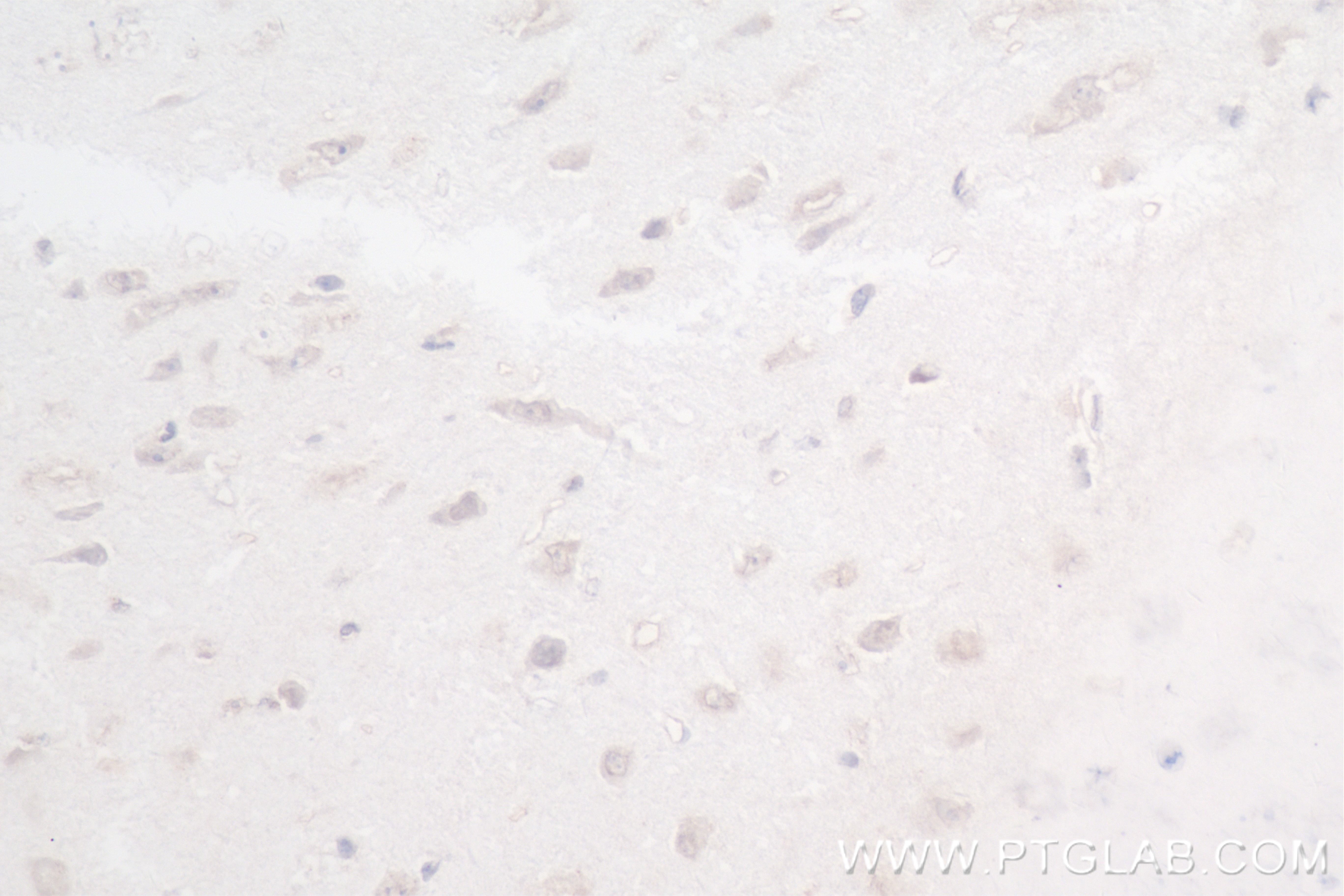 Immunohistochemistry (IHC) staining of mouse brain tissue using ATM Recombinant antibody (83608-5-RR)