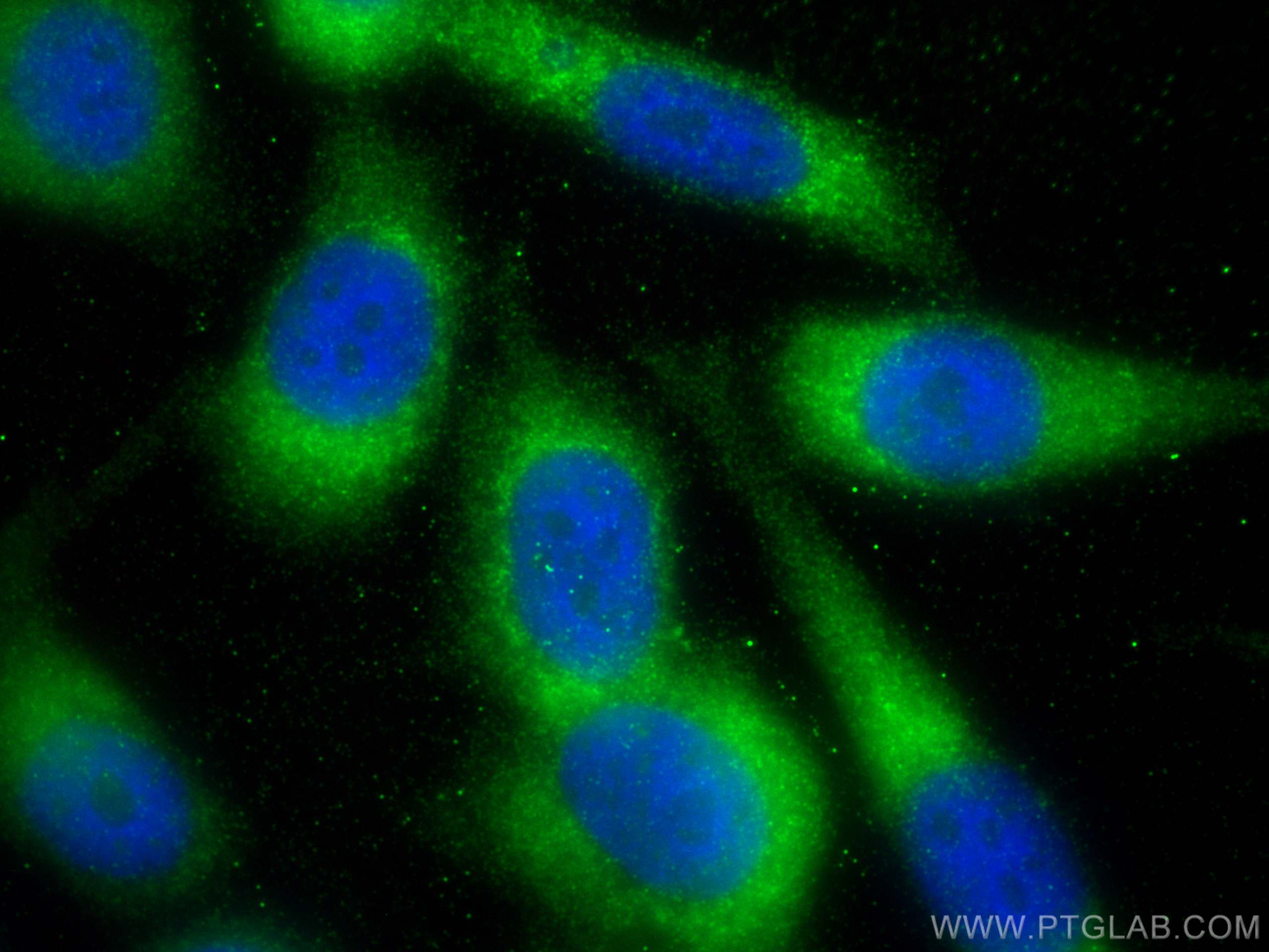 Immunofluorescence (IF) / fluorescent staining of PC-3 cells using ATOX1 Polyclonal antibody (22641-1-AP)