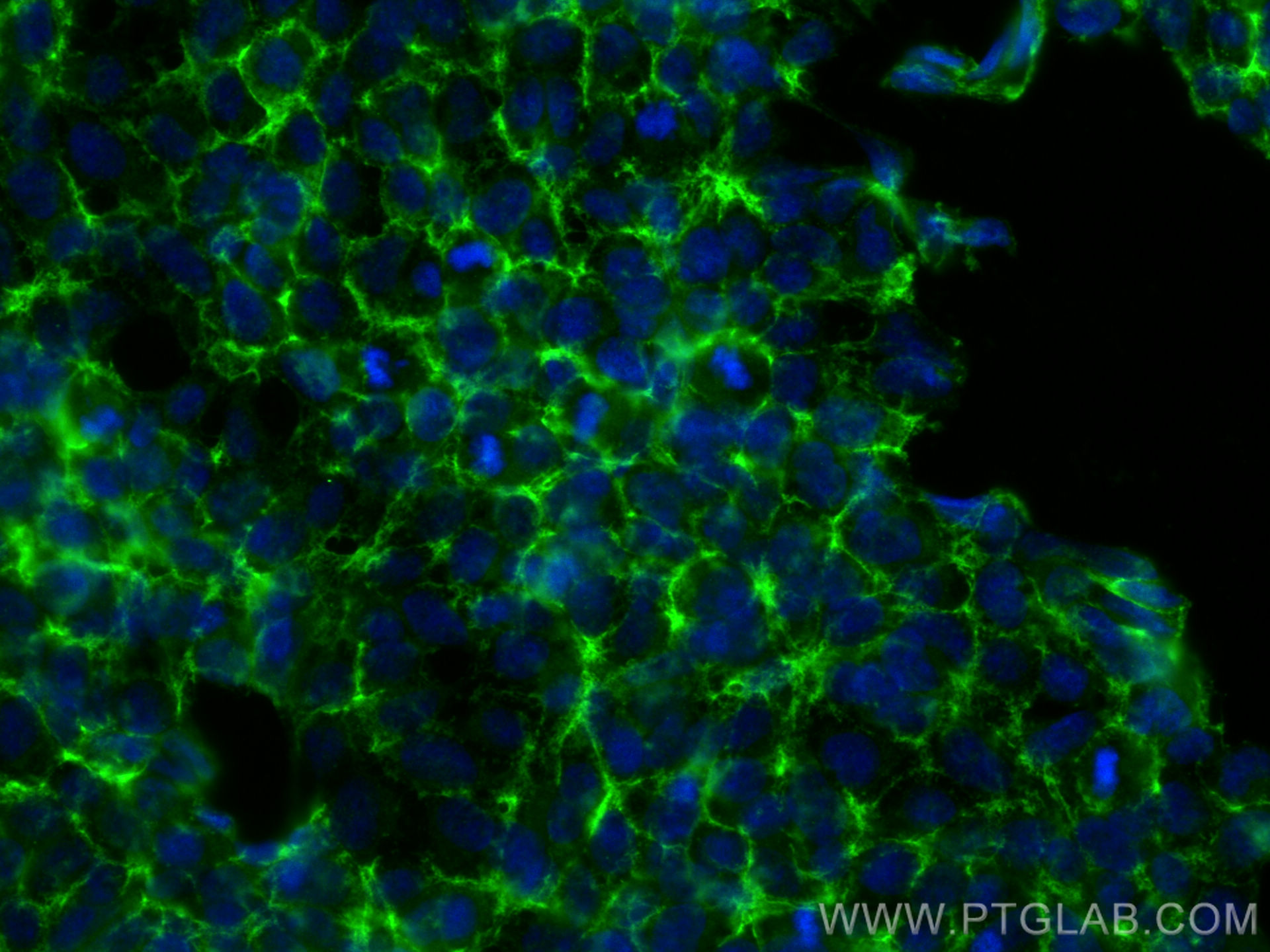 Immunofluorescence (IF) / fluorescent staining of HEK-293 cells using ATP11B Polyclonal antibody (13672-1-AP)