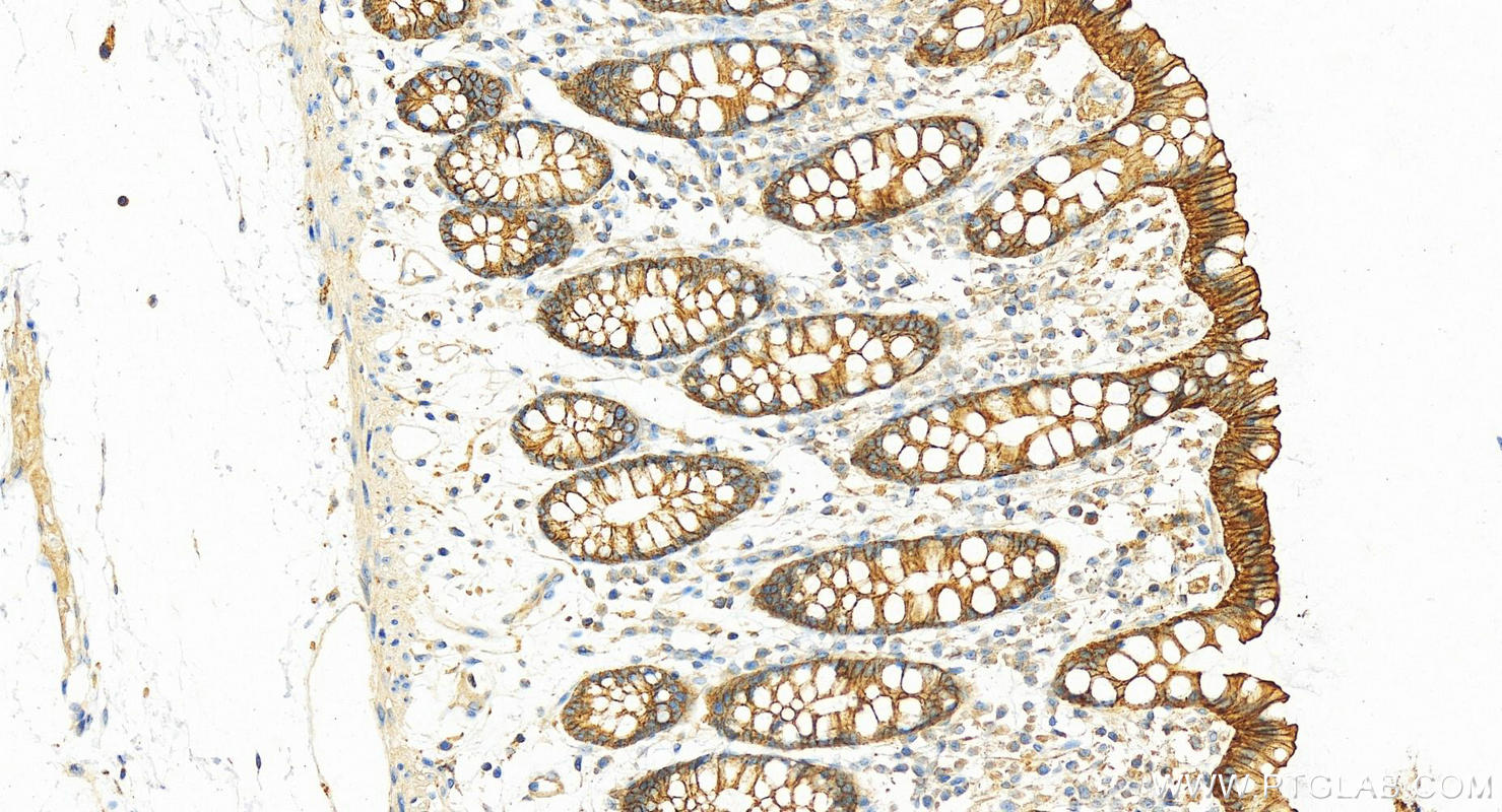 Immunohistochemistry (IHC) staining of human colon tissue using ATP1A1 Polyclonal antibody (14418-1-AP)