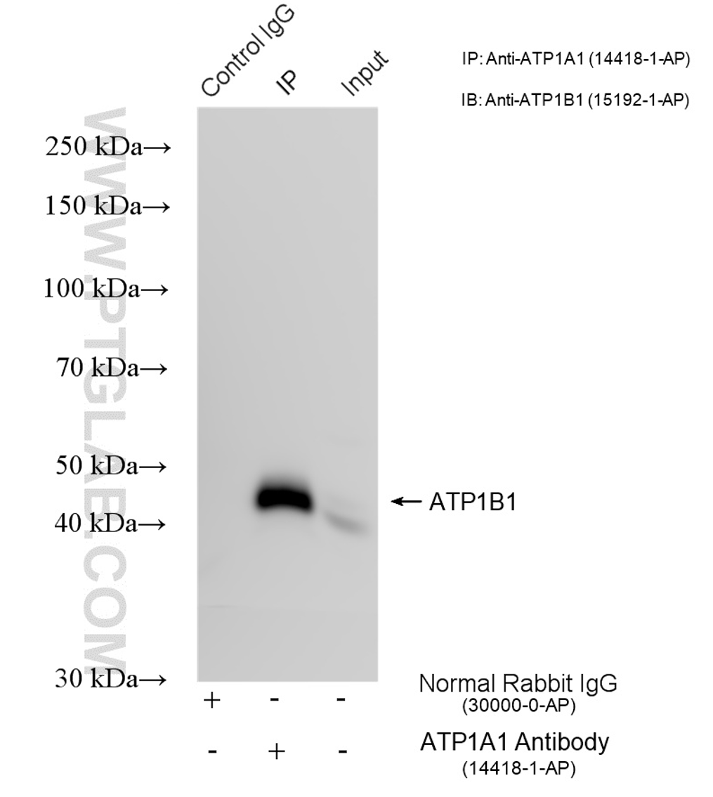 CoIP experiment of A431 cells using ATP1A1 Polyclonal antibody (14418-1-AP)