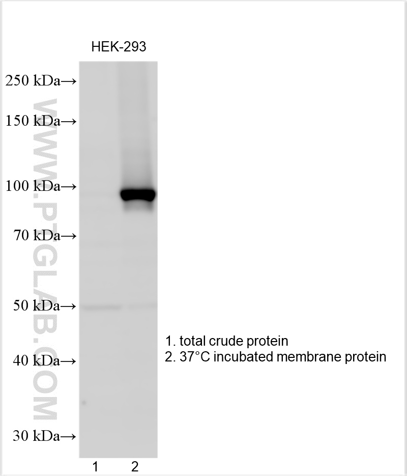 Western Blot (WB) analysis of various lysates using ATP1A1 Polyclonal antibody (14418-1-AP)