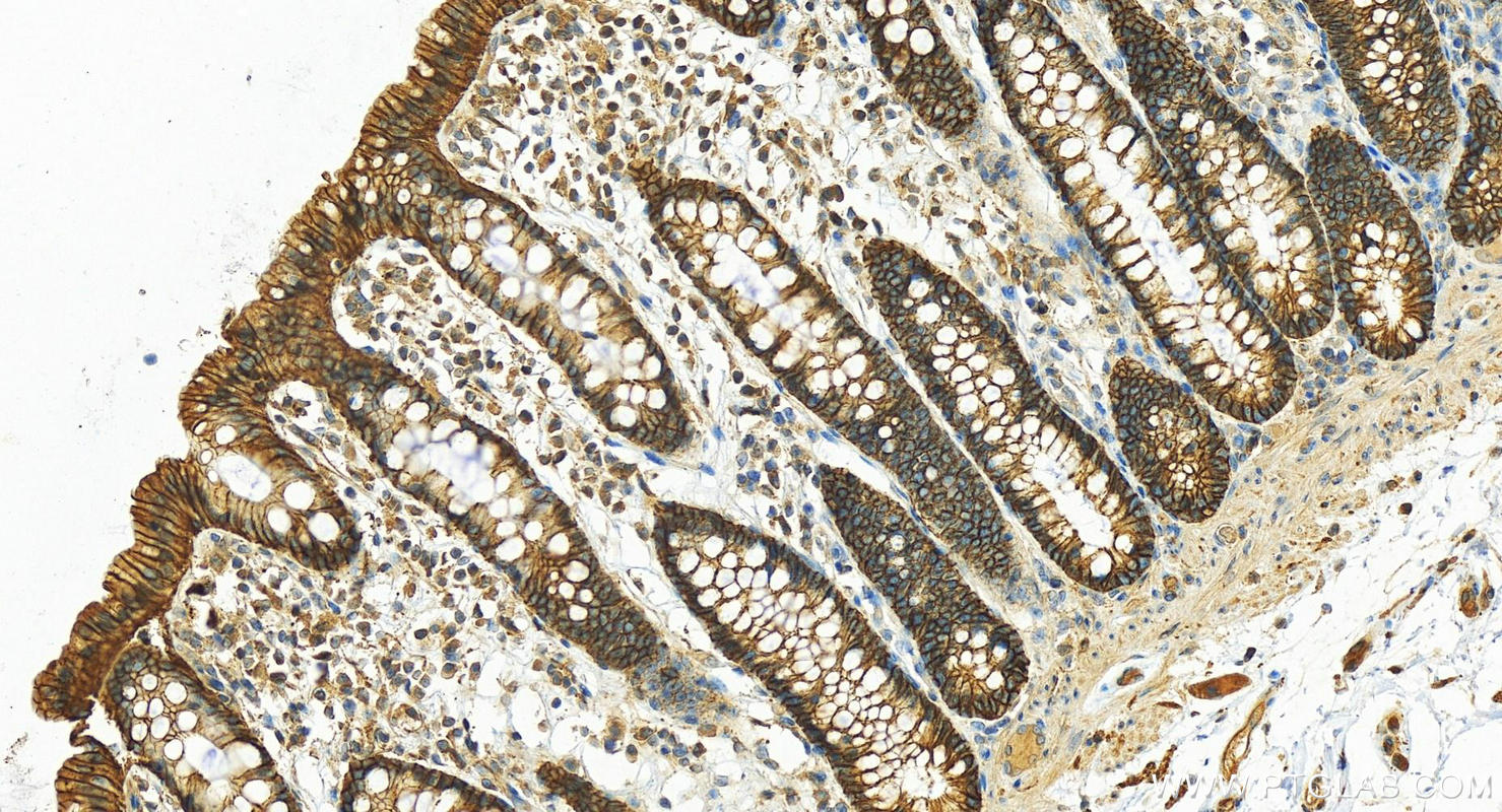 Immunohistochemistry (IHC) staining of human colon tissue using ATP1A1-Specific Polyclonal antibody (55187-1-AP)