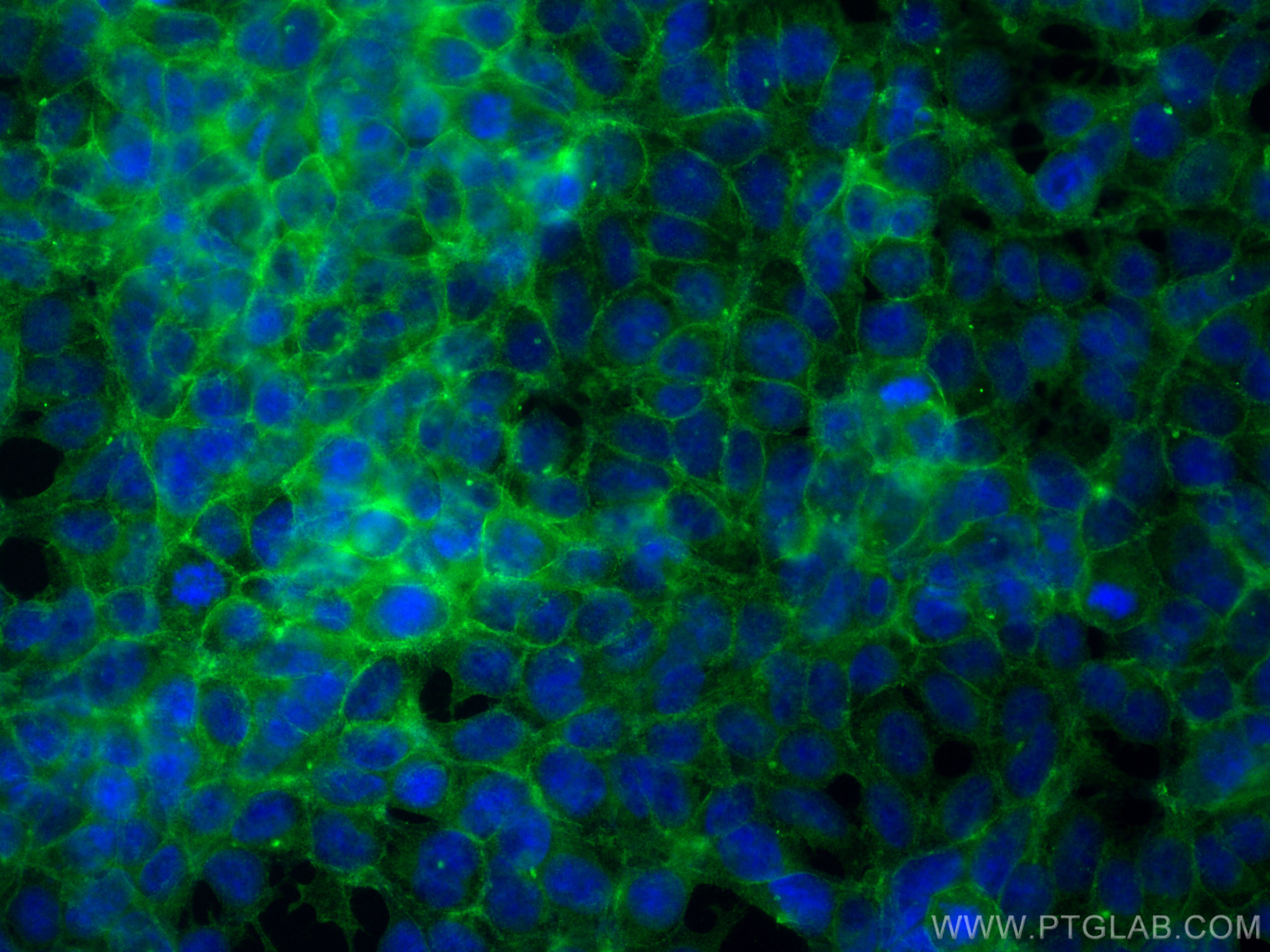 Immunofluorescence (IF) / fluorescent staining of HEK-293 cells using ATP1A1 Monoclonal antibody (68735-2-Ig)