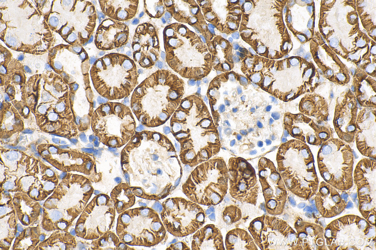 Immunohistochemistry (IHC) staining of mouse kidney tissue using ATP1A1 Monoclonal antibody (68735-2-Ig)