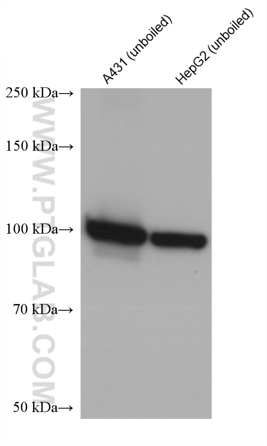 Western Blot (WB) analysis of various lysates using ATP1A1 Monoclonal antibody (68735-2-Ig)