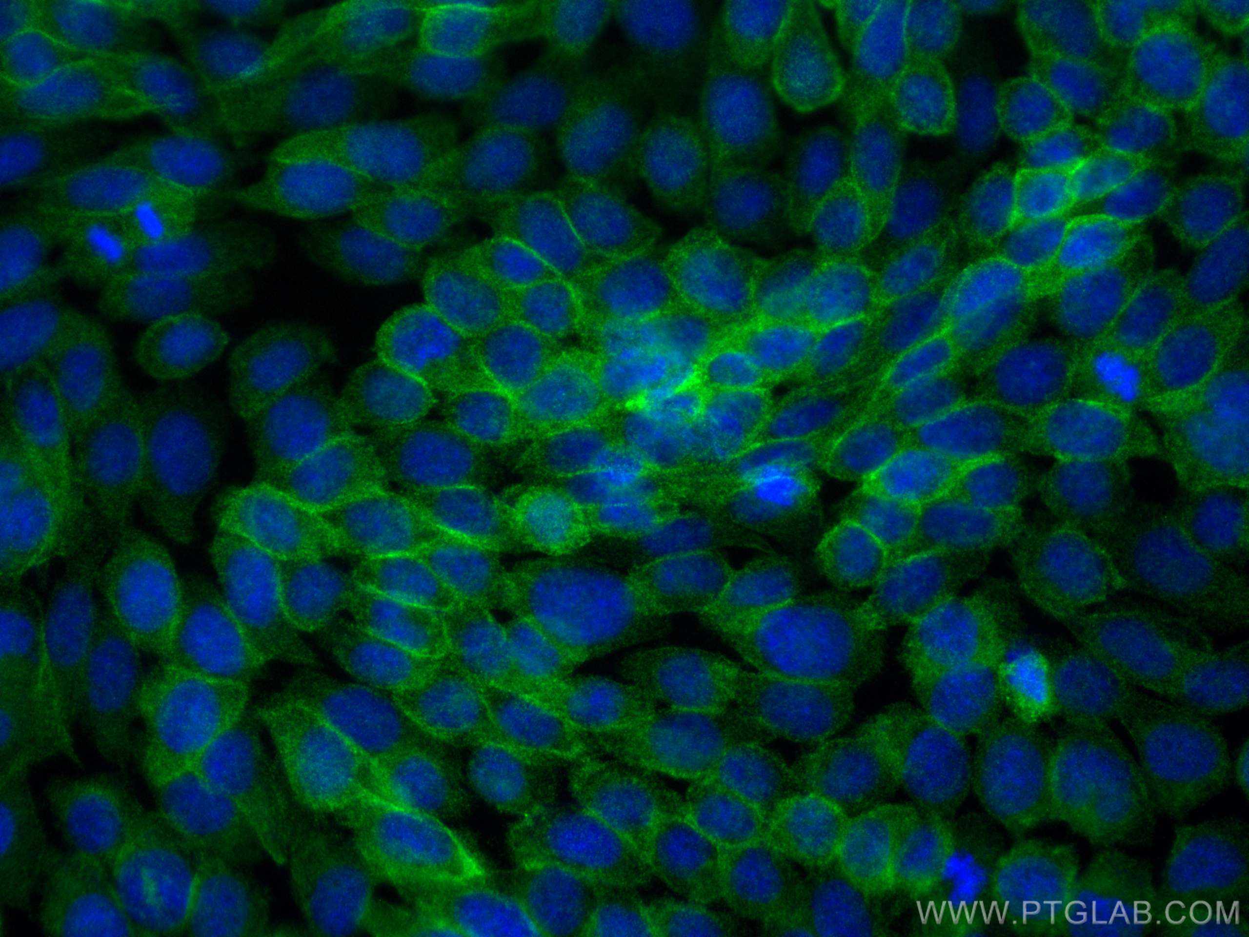 Immunofluorescence (IF) / fluorescent staining of A431 cells using ATP1A1 Recombinant antibody (83191-5-RR)