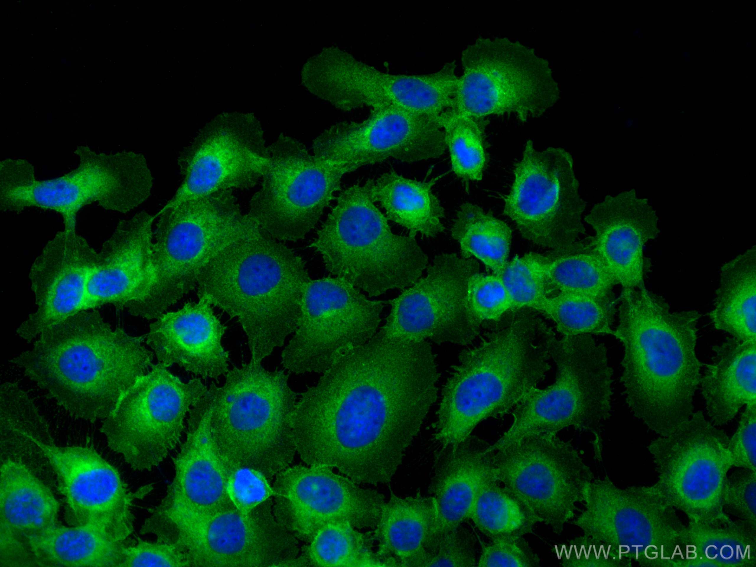 Immunofluorescence (IF) / fluorescent staining of A431 cells using ATP1A1 Recombinant antibody (83191-6-RR)