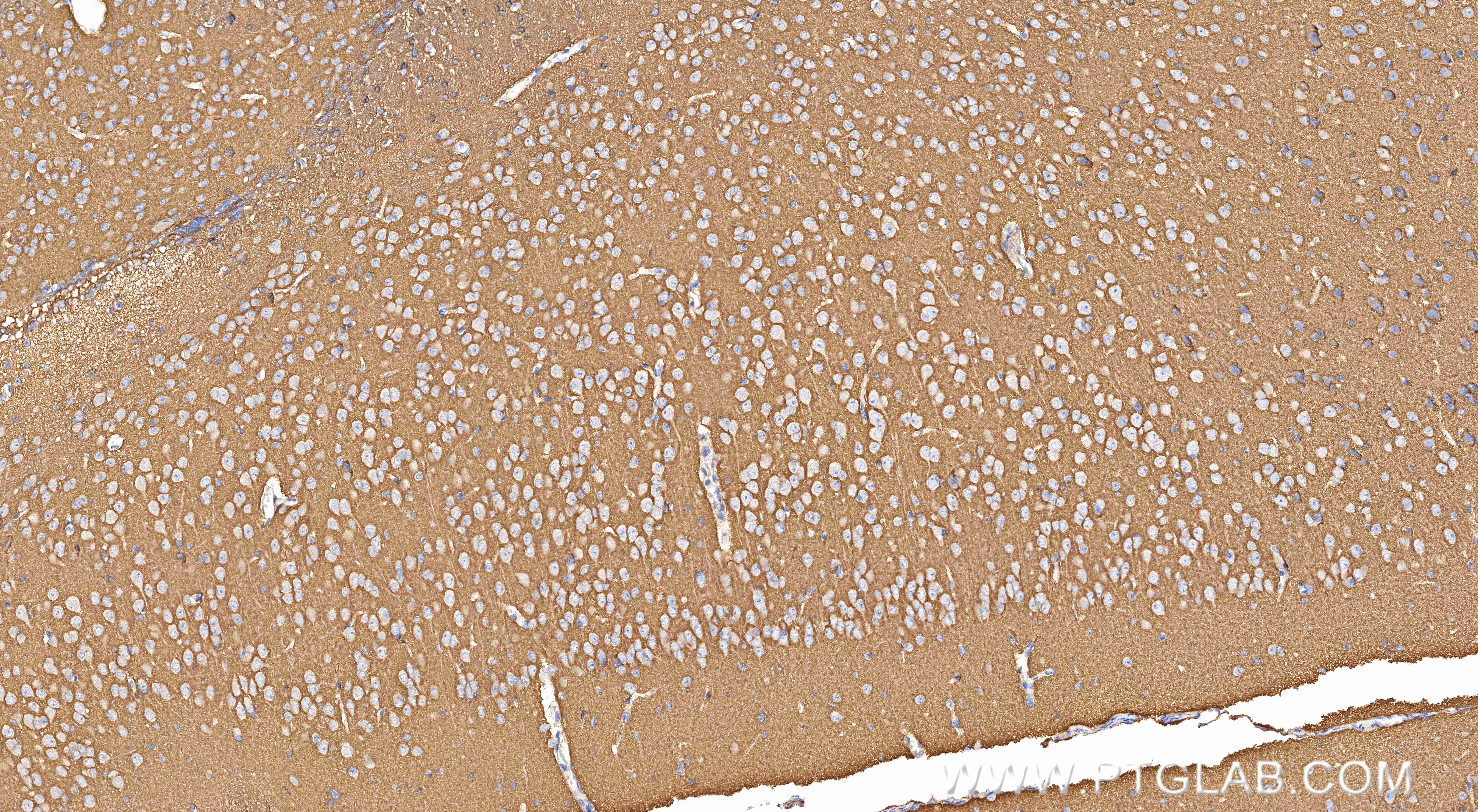 Immunohistochemistry (IHC) staining of mouse brain tissue using ATP1A1 Recombinant monoclonal antibody (83191-6-RR)