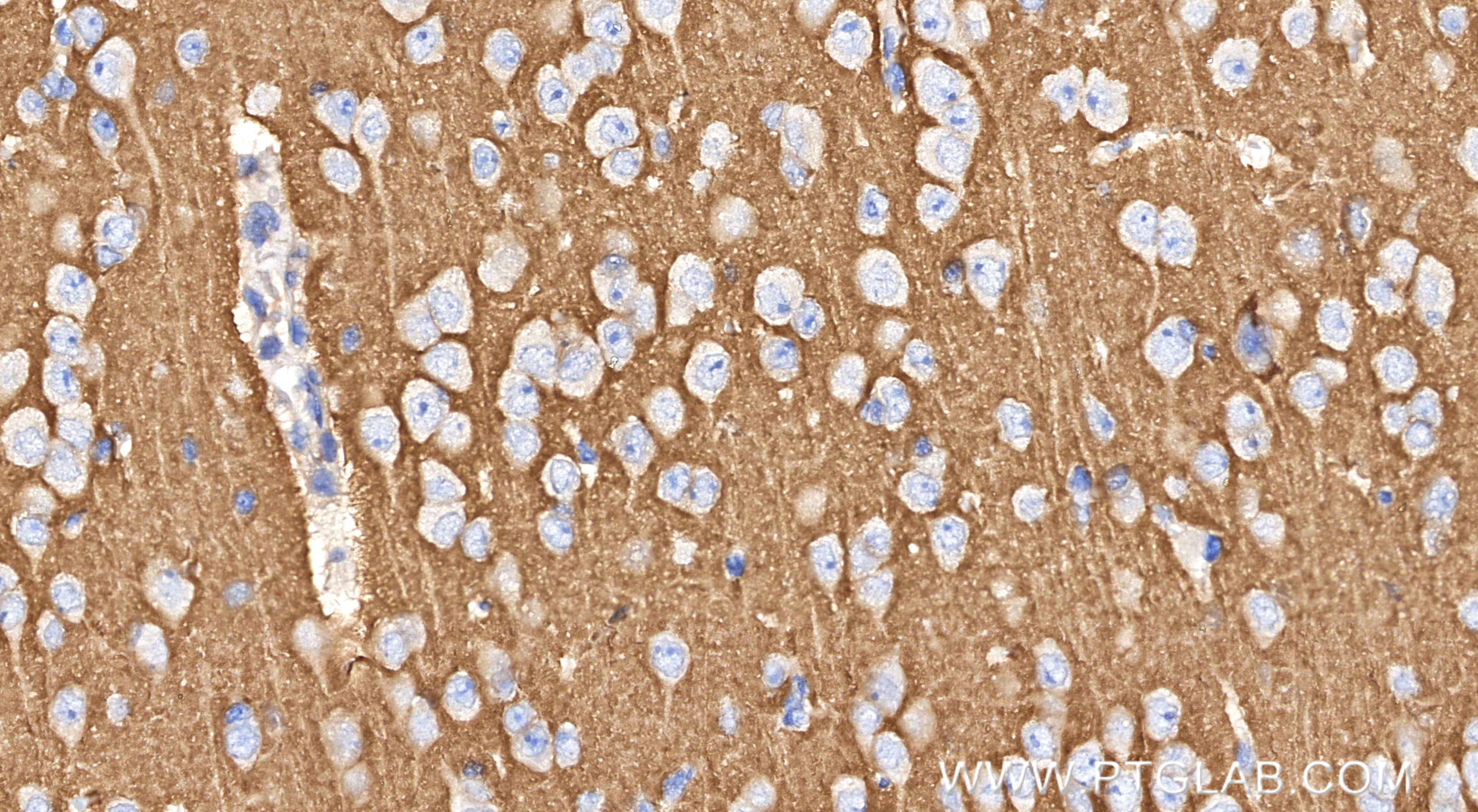 Immunohistochemistry (IHC) staining of mouse brain tissue using ATP1A1 Recombinant monoclonal antibody (83191-6-RR)