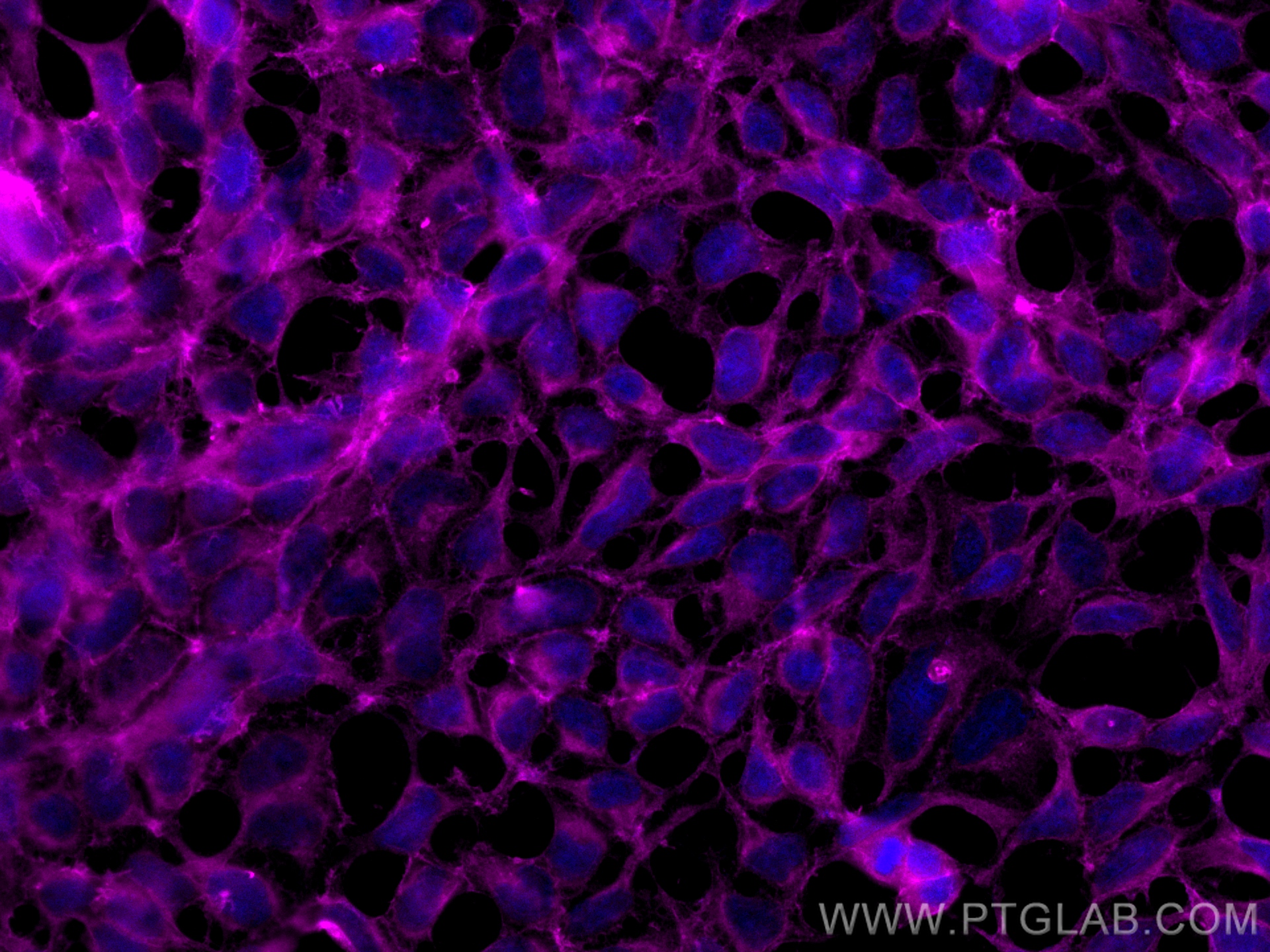 Immunofluorescence (IF) / fluorescent staining of HEK-293 cells using CoraLite® Plus 647-conjugated ATP1A1-Specific Poly (CL647-55187)