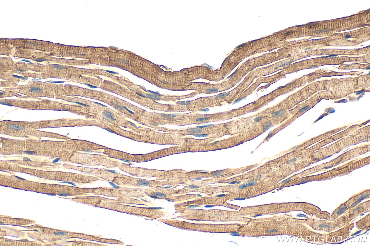 Immunohistochemistry (IHC) staining of mouse heart tissue using ATP1A1/2/3/4 Polyclonal antibody (16836-1-AP)