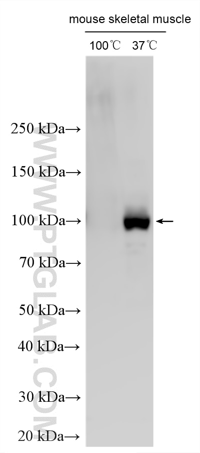 Western Blot (WB) analysis of various lysates using ATP1A1/2/3/4 Polyclonal antibody (16836-1-AP)