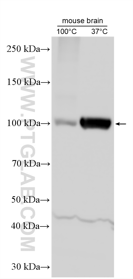 Western Blot (WB) analysis of various lysates using ATP1A2-Specific Polyclonal antibody (55179-1-AP)