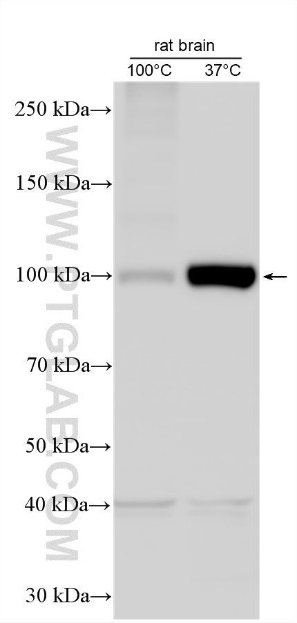 Western Blot (WB) analysis of various lysates using ATP1A2-Specific Polyclonal antibody (55179-1-AP)