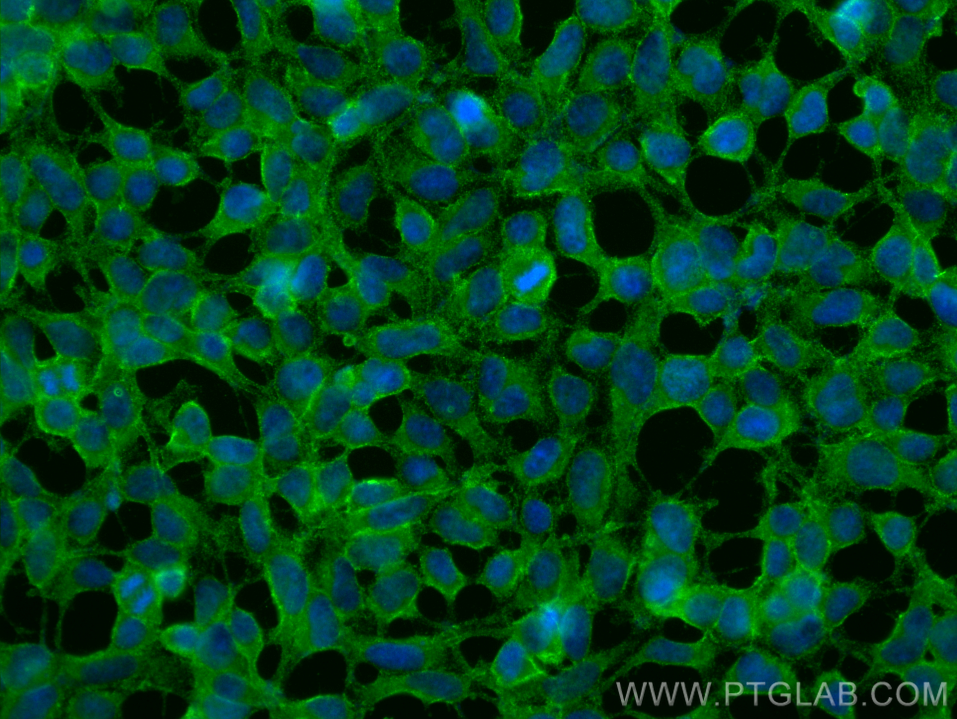 Immunofluorescence (IF) / fluorescent staining of HEK-293 cells using ATP1A1/2 Monoclonal antibody (68505-1-Ig)