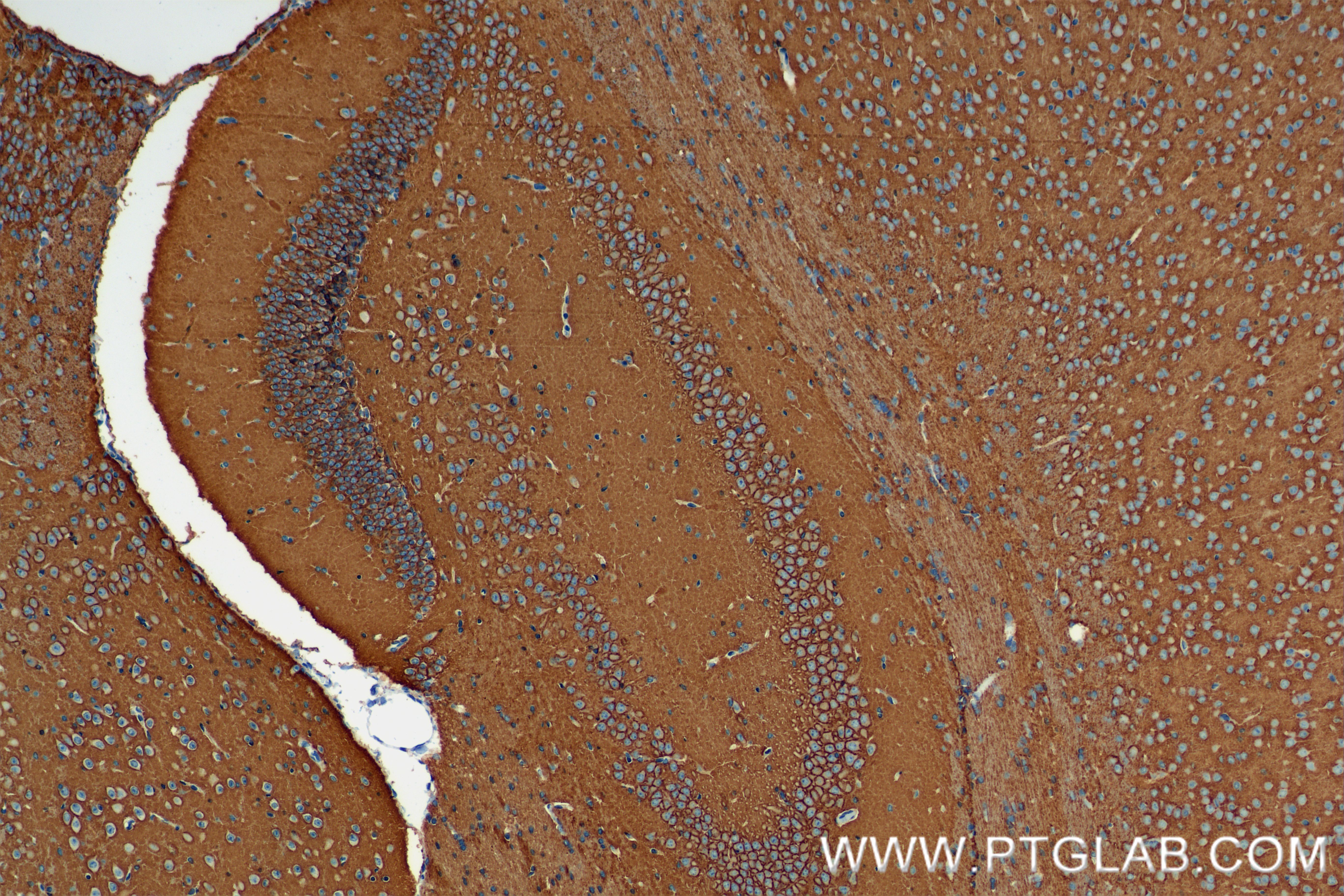 Immunohistochemistry (IHC) staining of mouse brain tissue using ATP1B1 Recombinant antibody (84707-5-RR)