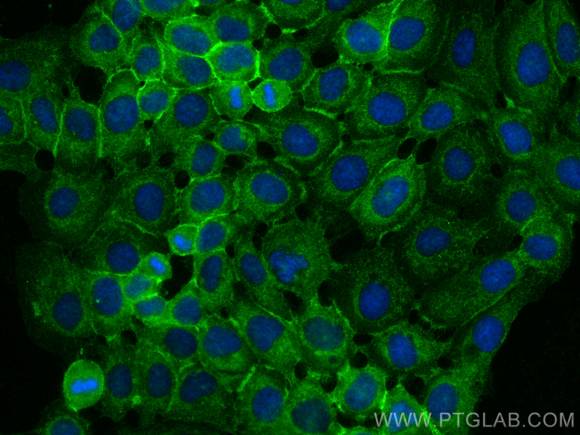 Immunofluorescence (IF) / fluorescent staining of A431 cells using ATP1B3 Polyclonal antibody (11142-1-AP)