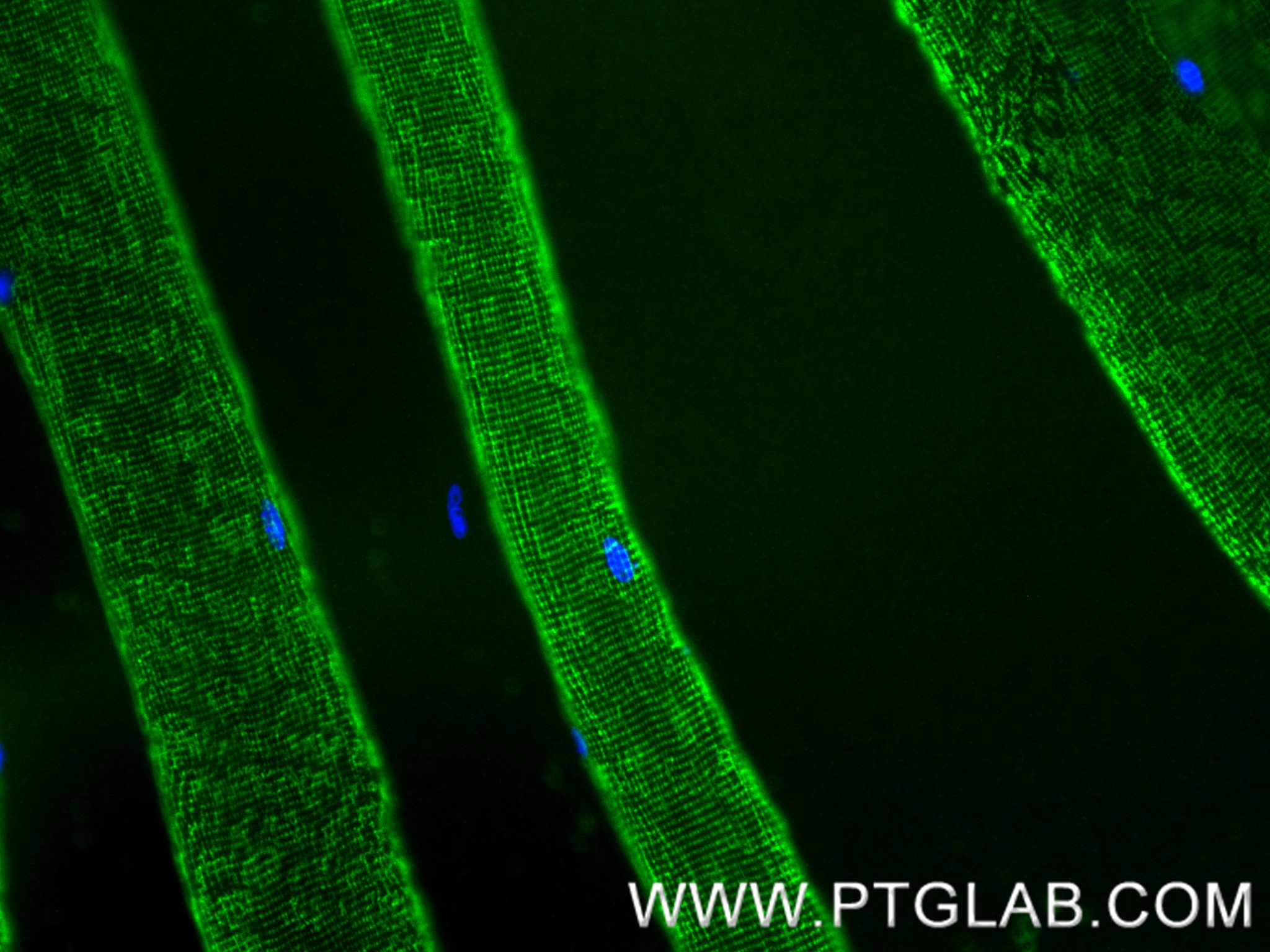 Immunofluorescence (IF) / fluorescent staining of mouse skeletal muscle tissue using ATP2A1 Recombinant antibody (84213-5-RR)