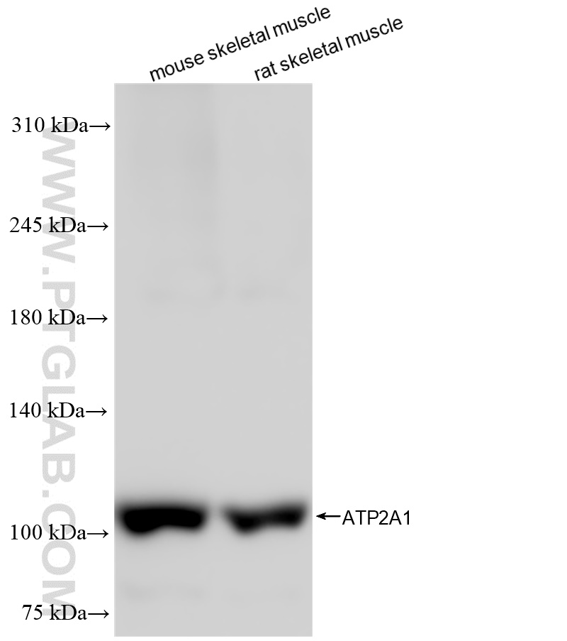 Western Blot (WB) analysis of various lysates using ATP2A1 Recombinant antibody (84213-5-RR)