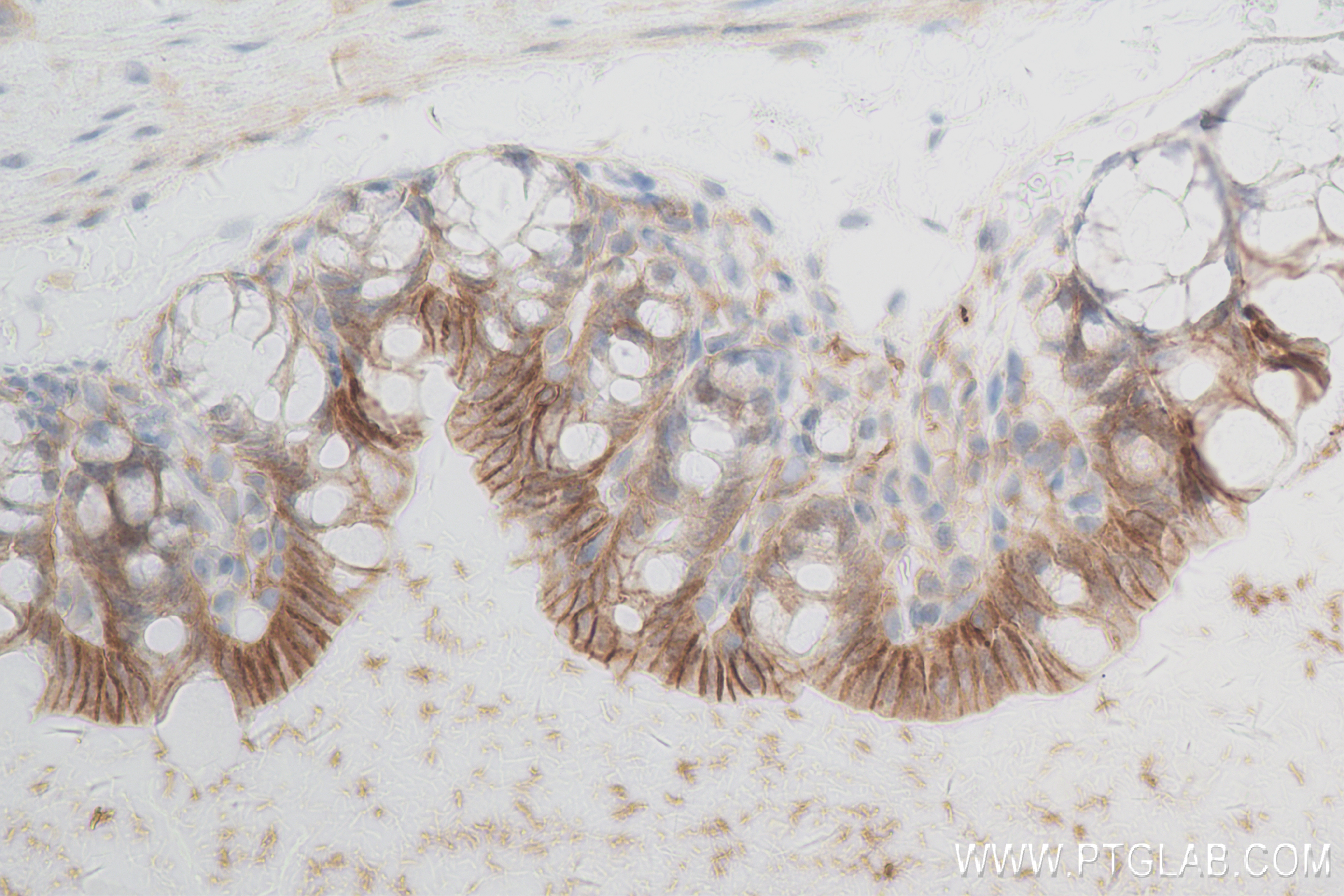 Immunohistochemistry (IHC) staining of mouse small intestine tissue using ATP2B1 Recombinant antibody (83827-3-RR)