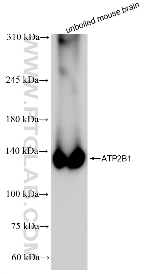 Western Blot (WB) analysis of mouse brain tissue using ATP2B1 Recombinant antibody (83827-3-RR)