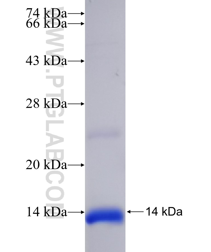 ATP2B1 fusion protein Ag32397 SDS-PAGE